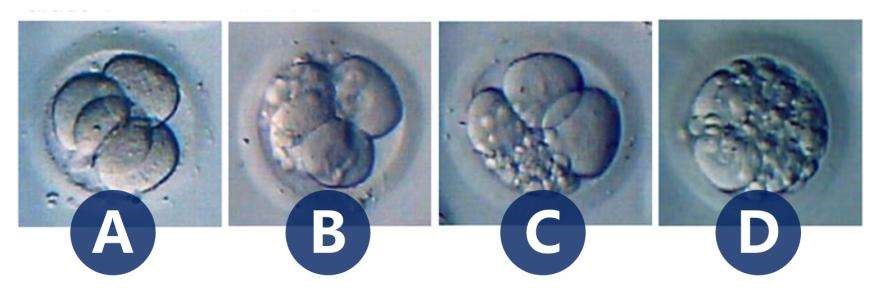 囊胚移植囊胚级别