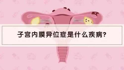 子宫内膜异位症是什么