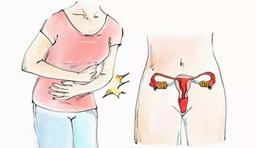 子宫腔积液的典型症状