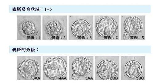囊胚等级.jpg