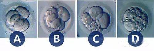 胚胎质量