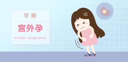 宫外孕的症状.jpg