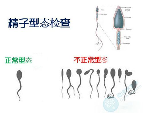 精子形态.jpg