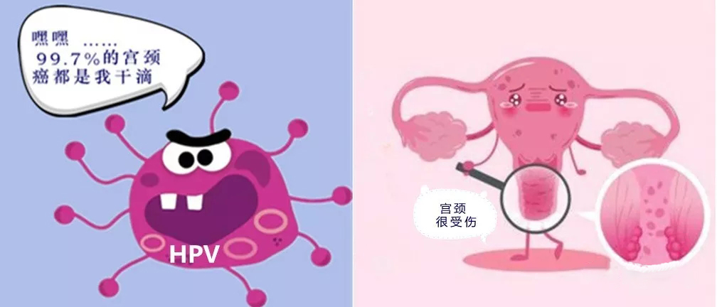 橄榄树生命——宫颈癌和HPV