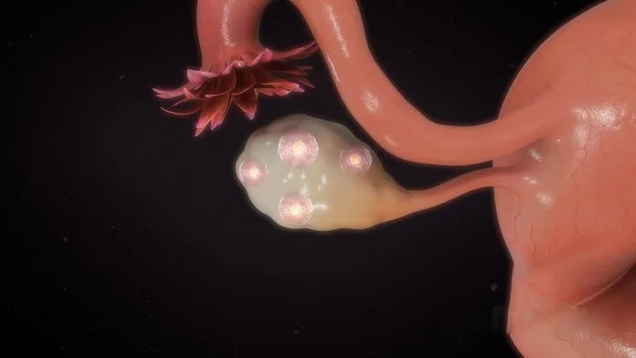 橄榄树生命——胚胎染色体异常
