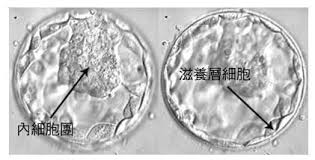 橄榄树生命——囊胚