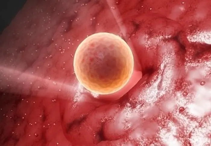 橄榄树生命——胚胎移植