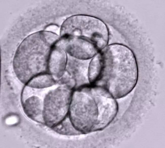 橄榄树生命——8细胞胚胎