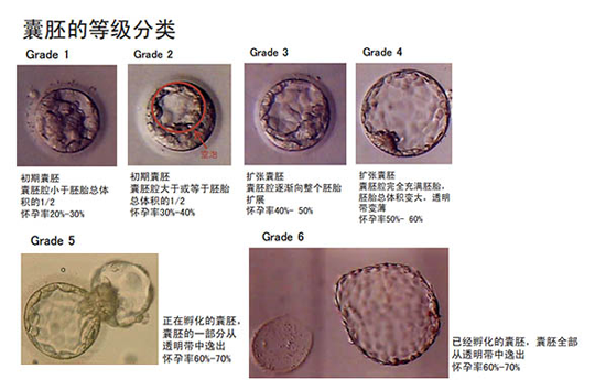 橄榄树生命——囊胚发育等级分类