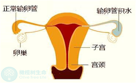 影响试管成功有哪三类疾病，试管技术如何成功好孕？