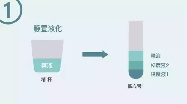 橄榄树生命——精子洗涤术