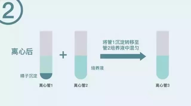 橄榄树生命——精子洗涤术