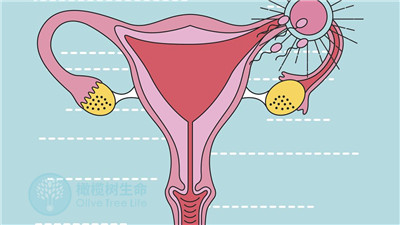 分析输卵管结核对生育的影响，三代试管保障活产率