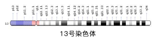 13号染色体异常