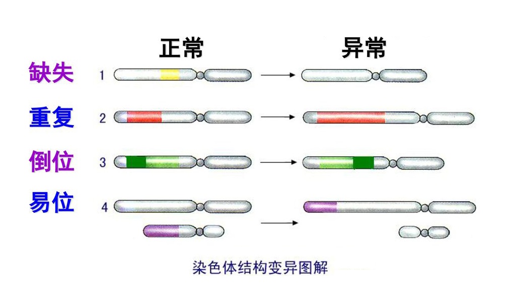 染色体异常