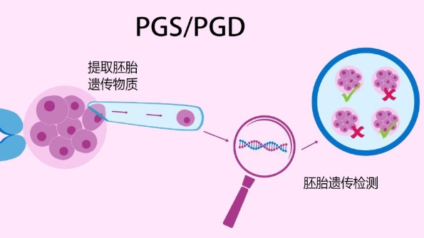 三代试管PGD/PGS技术