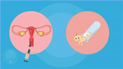 泰国试管婴儿单囊胚移植的意义和好处是什么？