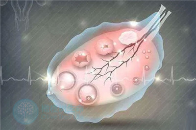 去泰国试管婴儿：促排卵环节何时打破卵针合适？