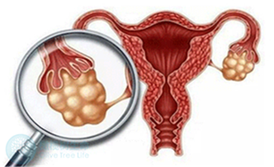 如何保养卵巢，这些损害卵巢因素你得知道