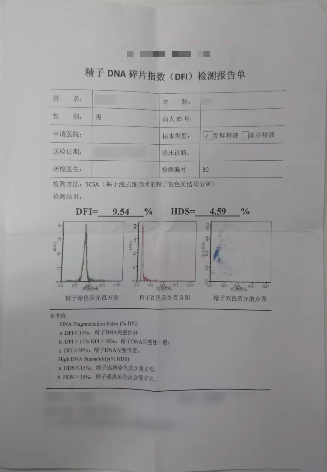 精液检查