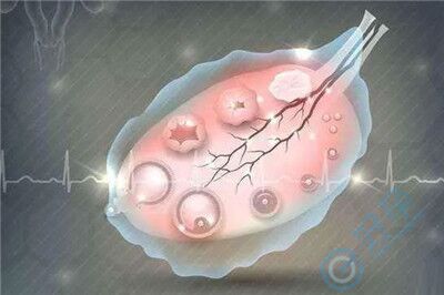 患有多囊卵巢做试管婴儿，可以取到健康卵子吗？