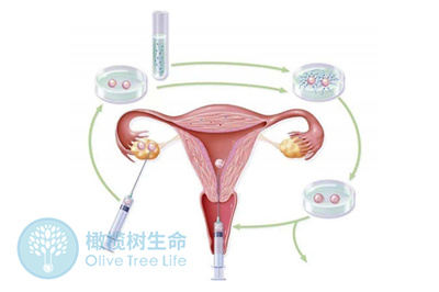 科学试管助孕帮您解决排卵障碍致不孕问题