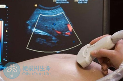 大龄女性去泰国做试管婴儿，有哪些是必须要注意的？