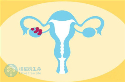 基础卵泡<5个，去泰国做试管婴儿还能成功吗？