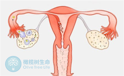 卵巢囊肿的女性做试管婴儿前，需要先切除吗？
