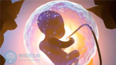 做第三代试管婴儿，胎儿会不会有早产的风险？