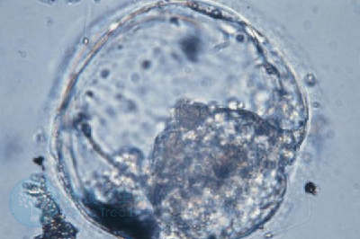 胚胎受精过程失败，究竟是精子的错还是因为卵子的错