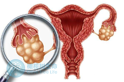 【高龄生育】如何提高卵子质量、降低妊娠风险？