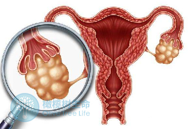 基础卵泡数量少但有卵子，但为什么取不到卵子呢？