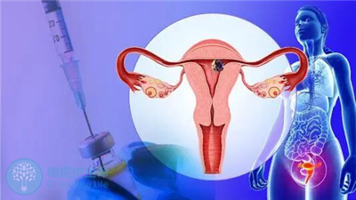 试管胚胎移植前必须做宫腔镜检查吗？