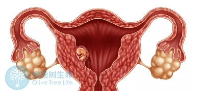 试管婴儿胚胎移植后，怎么促进HCG翻倍？
