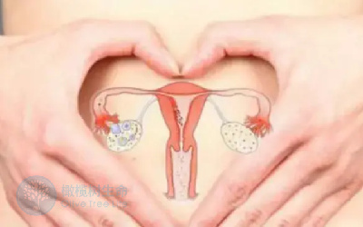试管如何解决多囊卵巢面临的生育问题？