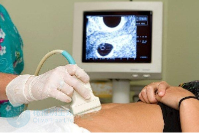 试管婴儿促排卵会导致女性提前闭经吗？