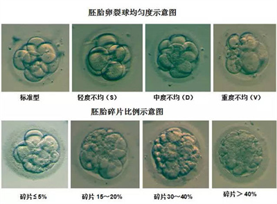 胚胎碎片于泰国试管婴儿有何影响?如何预防?