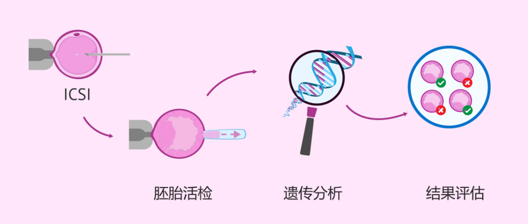 预防出生缺陷日 | 第三代试管婴儿技术能避免出生缺陷吗?