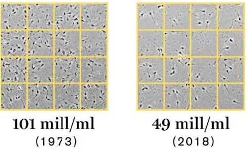 男性精子数量下降的关键因素，你一定想不到！