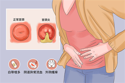 试管婴儿移植后，慢性宫颈炎会导致胎停流产吗？