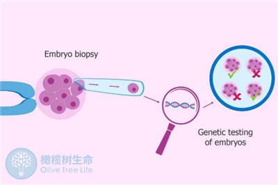 详谈第三代试管婴儿基因诊断/染色体筛查技术