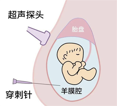 世界唐氏综合征日 | 知“唐”控“唐”，孕育健康宝宝!