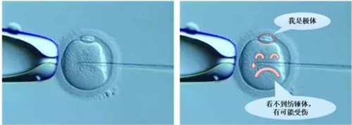 试管反复失败，新技术可让优胚率提升23%！