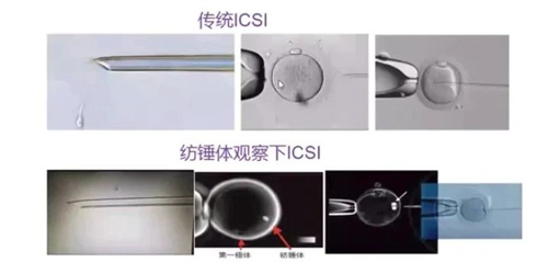 试管反复失败，新技术可让优胚率提升23%！