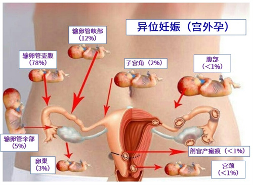 胚胎移植后出血≠流产！搞清楚情况才能找准方法！