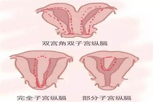 怀得上留不住，做试管婴儿前可能是这几个方面出了问题
