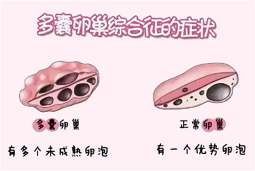 怀得上留不住，做试管婴儿前可能是这几个方面出了问题