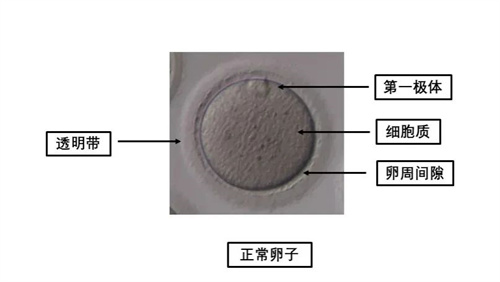 卵母细胞形态学异常对试管婴儿有什么影响？