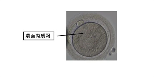 卵母细胞形态学异常对试管婴儿有什么影响？